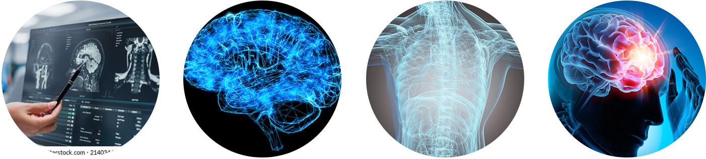 Set of four circular images. One shows a hand with a pen pointing at a screen with a brain scan, another displays a detailed brain scan, the third is a neuroscan, and the fourth illustrates a trigger point nerve, representing advanced neurological diagnostics and treatments by a neurologists at Viva Medical Center in Doral, Florida